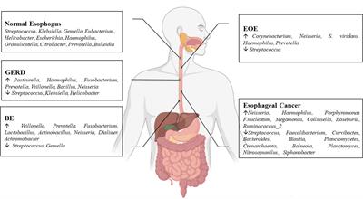 Esophageal microflora in esophageal diseases